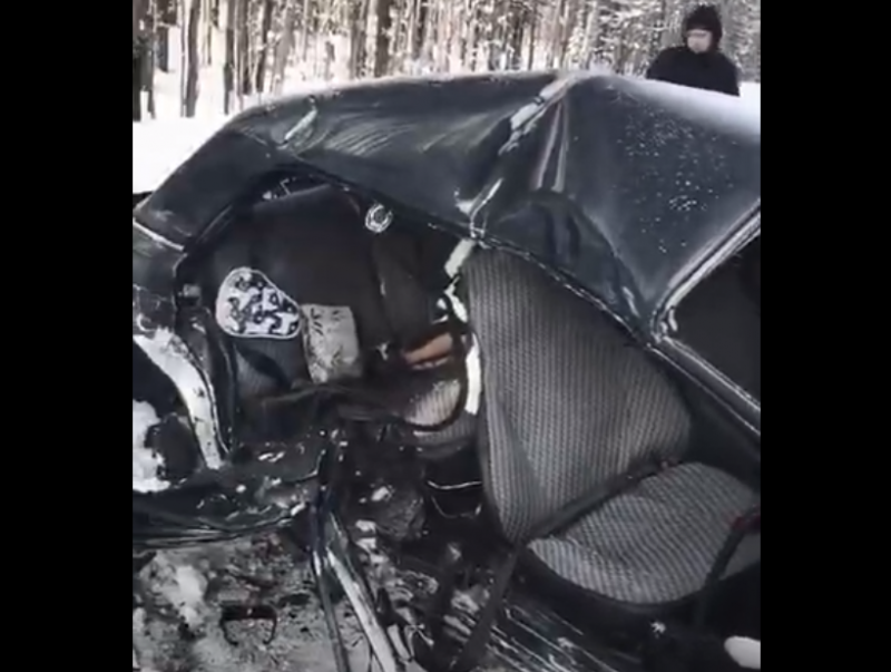 Пострадавший в ДТП под Сосногорском годовалый ребенок остается в тяжелом состоянии