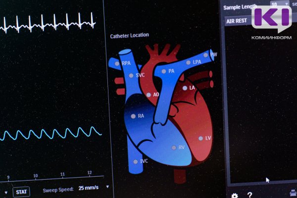 Из аптек Сыктывкара пропало лекарство для сердечников 