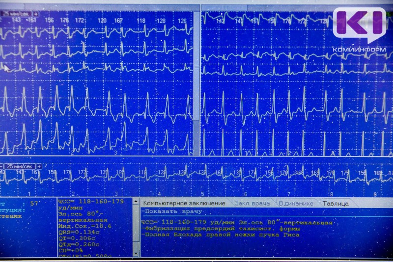 В Воркуте врач обвиняется в причинении смерти по неосторожности