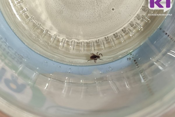 В Коми за неделю от укусов клещей пострадало 72 человека