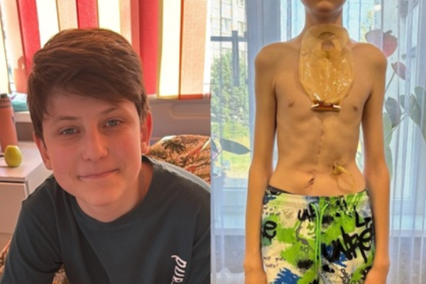 Спасти Никиту: 14-летнему уроженцу Ухты требуется помощь благотворителей для прохождения реабилитации