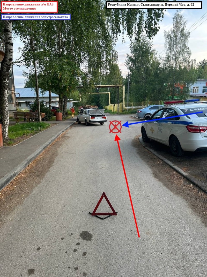В Сыктывкаре водитель ВАЗа отправил в больницу 8-летнего электросамокатчика
