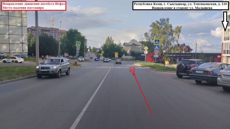 Пассажирка маршрута 17м в Сыктывкаре госпитализирована с ушибом головы