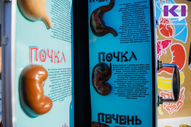 Внимание мужчинам от 30 до 60: что повышает вероятность образования камней в почках