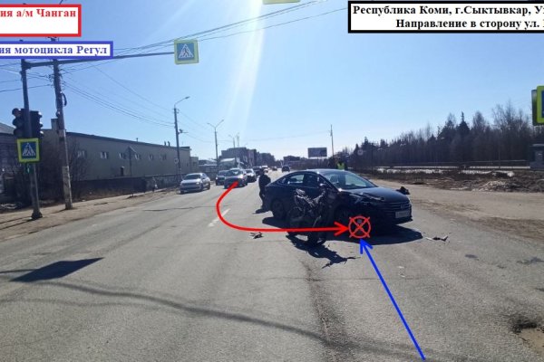 В Коми уголовное дело по факту ДТП, в котором пострадал подросток за рулем питбайка, направлено в суд

