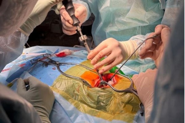 Команда врачей-нейрохирургов Эжвинской городской больницы успешно выполнила первую в регионе операцию по методике Хармса при переломе второго шейного позвонка
