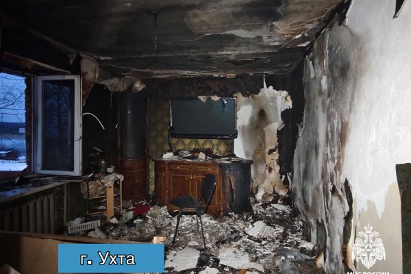В Ухте на пожаре пострадал мужчина