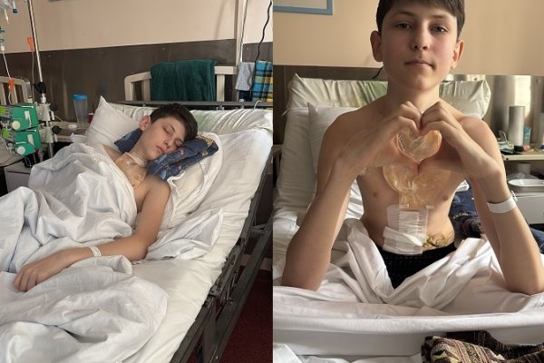 Битва за жизнь длиною в 12 лет: ухтинцу Никите Клокову нужна помощь неравнодушных 