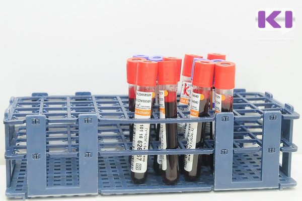 Лечение гепатита С в Коми станет доступнее в районных больницах