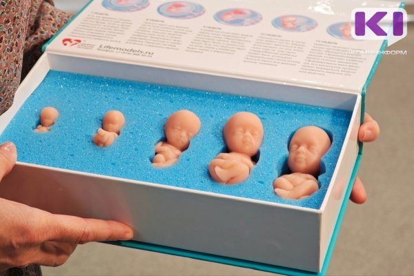 Руководитель Минздрава Коми: 