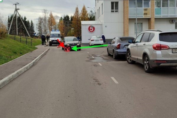 В Сыктывкаре водитель на Skoda наехал на ребенка