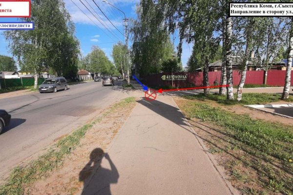 В Сыктывкаре школьница на велосипеде попала под колеса авто