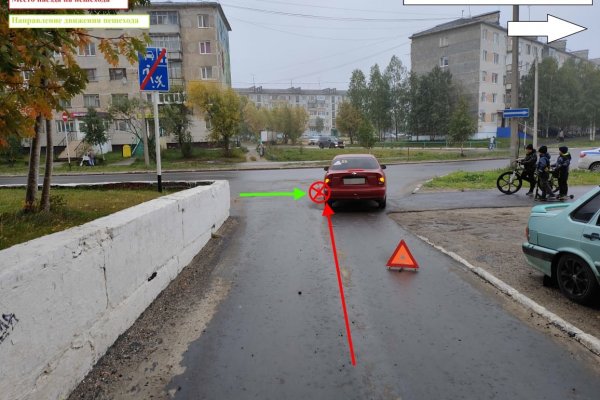 В Усинске водитель Chevrolet сбил шестилетнего ребенка на самокате