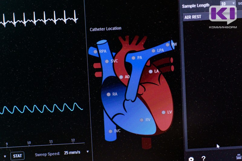 Пять больниц Коми получат новые электрокардиографы