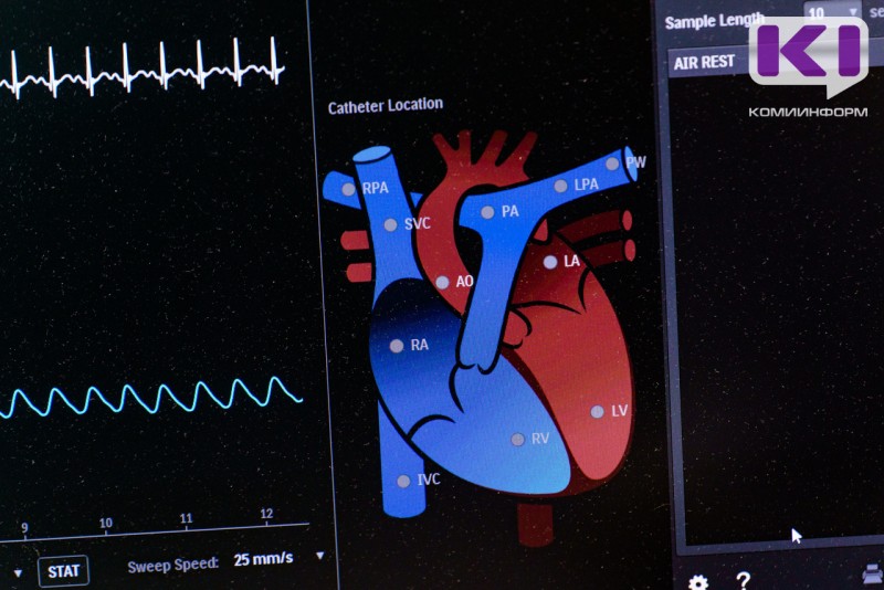 Врачи Кардиодиспансера Коми освоили новую технологию лечения и диагностики - внутрисосудистый ультразвук