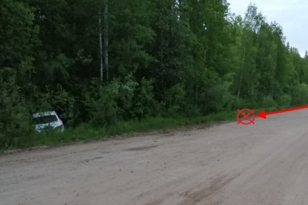 В Удорском районе госпитализирована участница ДТП с ожогом 