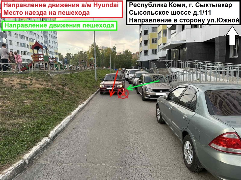 В Сыктывкаре пятилетний ребенок выбежал под колеса Hyundai Accent