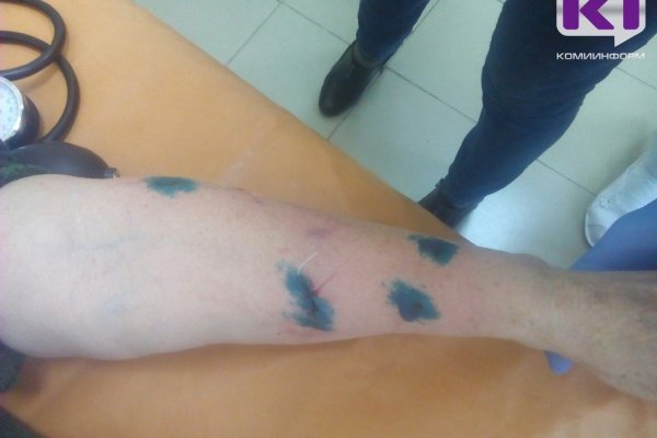 Госдума хочет увеличить штрафы нерадивым хозяевам собак до 50 тысяч рублей 